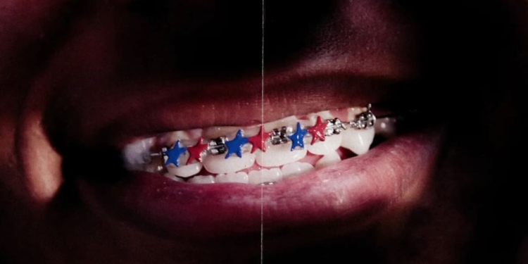 TwoJeys transforman los brackets de Lamine Yamal en una joya