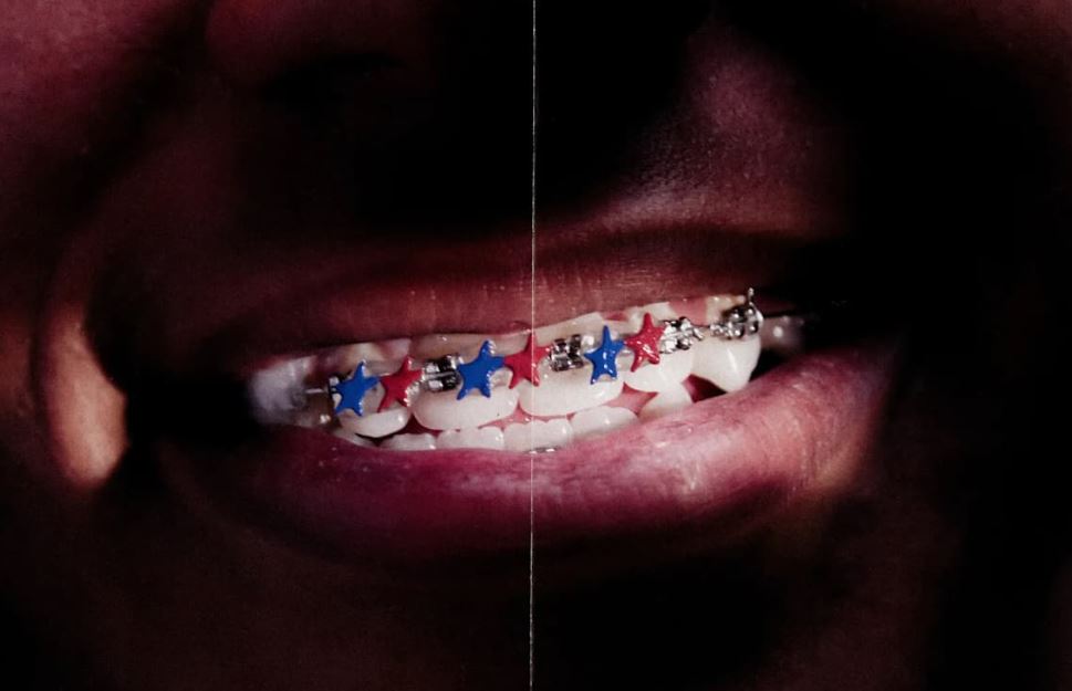 TwoJeys transforman los brackets de Lamine Yamal en una joya